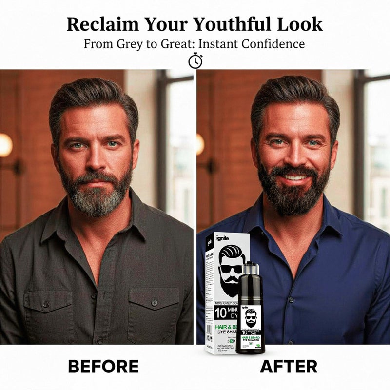 إجنايت شامبو صبغة شعر ولحية للرجال - تغطية كاملة للشعر الأبيض - صبغة سوداء - لون طبيعي 3 في 1 للشعر واللحية والشارب - Image 3